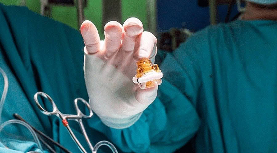 valve replacement surgery