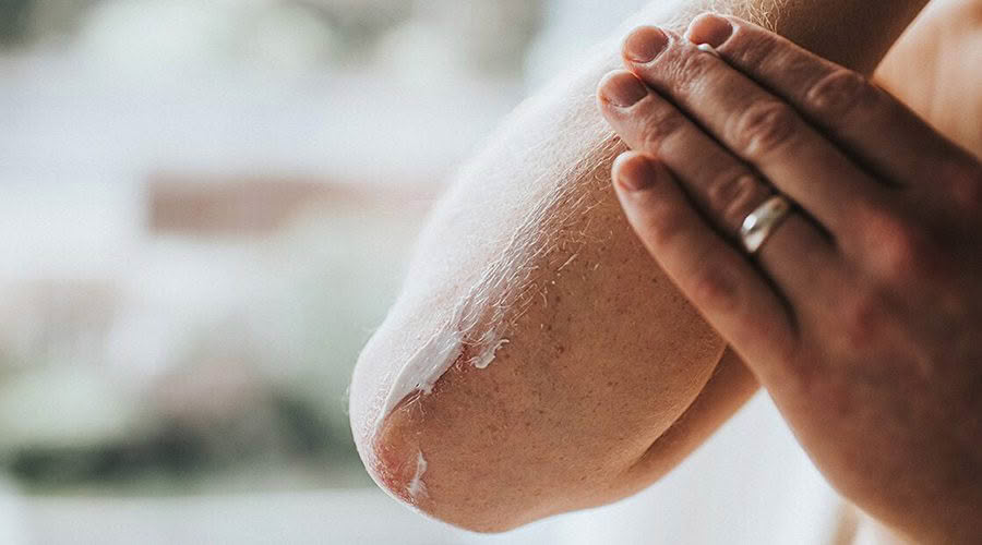 glucosamine cream